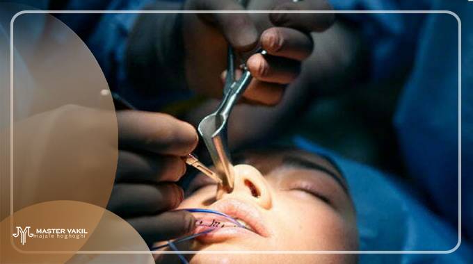 مراجع شکایت از جراح بینی